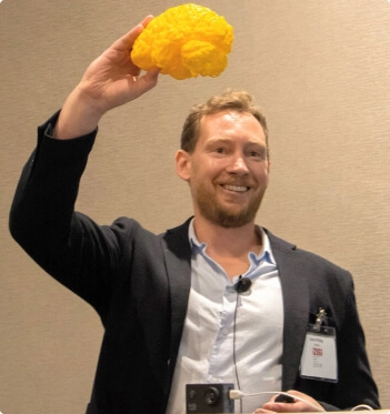 Owen with printed brain example