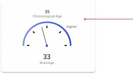 brain age