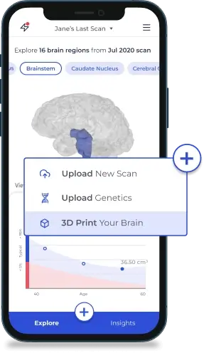 upload your mri scan